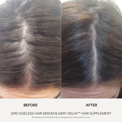 GRO AGELESS Gray Delay™ Hair Supplement