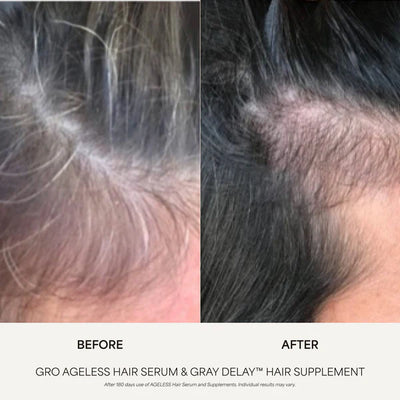 GRO AGELESS Gray Delay™ Hair Supplement (3 Pack)